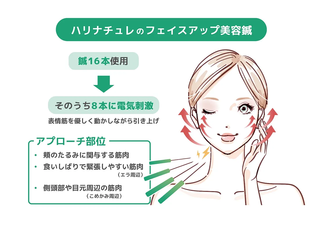 ハリナチュレのフェイスアップ美容鍼