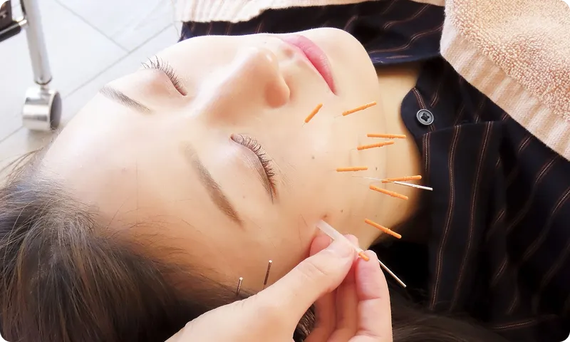 医師と共同開発した独自の美容鍼技術