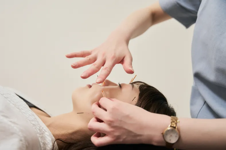 美容鍼の施術