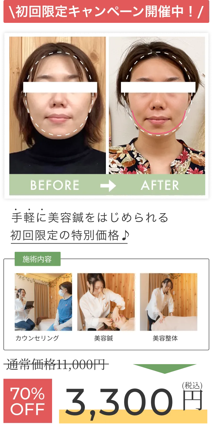 初回限定キャンペーン開催中！