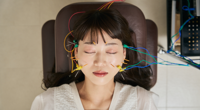 ハリナチュレの美容鍼