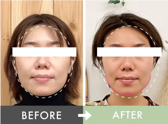 浮腫の頻度が減った！