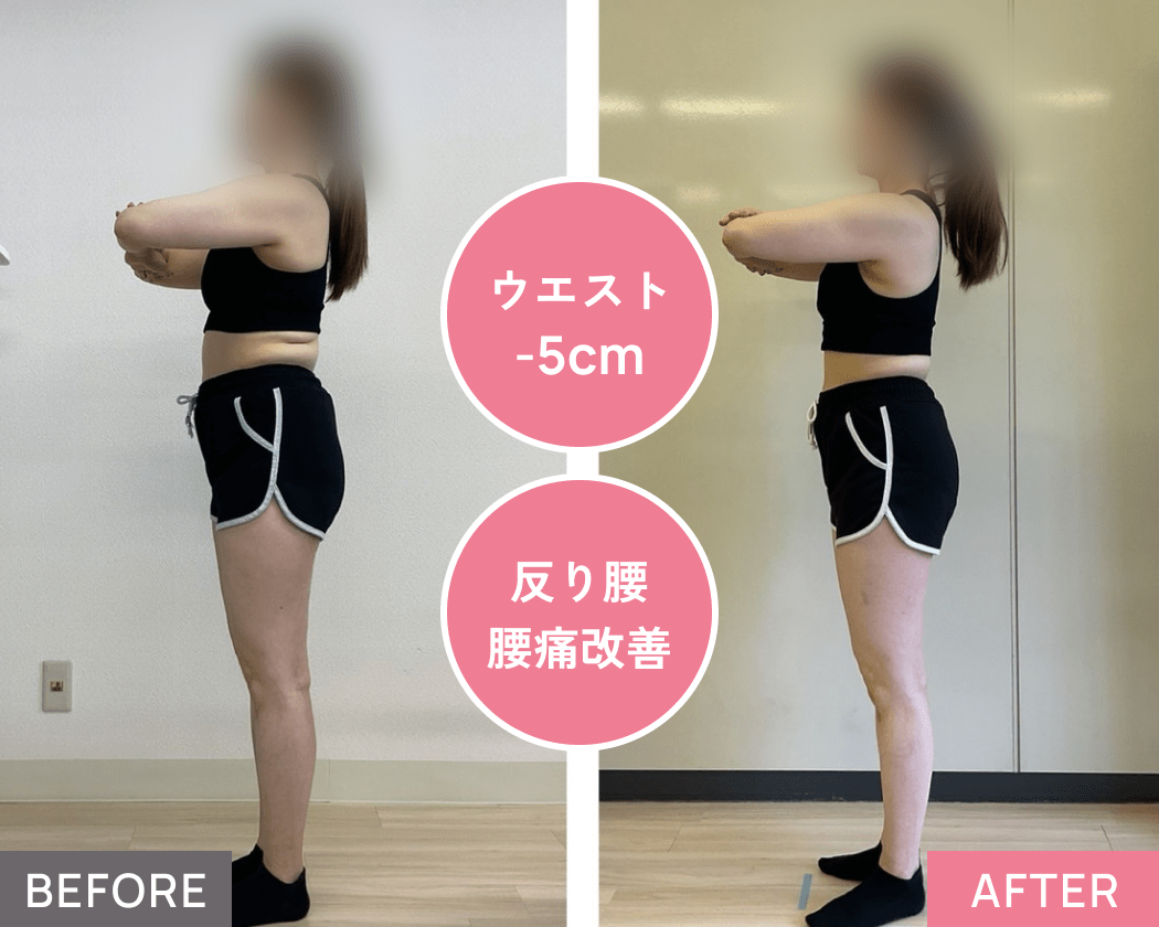 ウエスト、反り腰